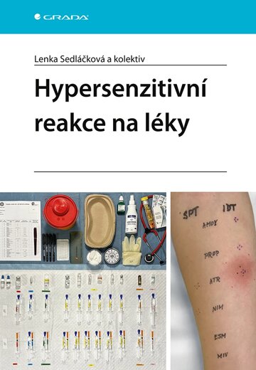 Obálka knihy Hypersenzitivní reakce na léky