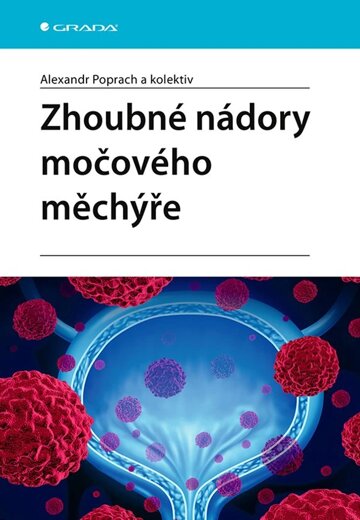 Obálka knihy Zhoubné nádory močového měchýře