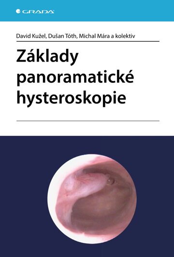 Obálka knihy Základy panoramatické hysteroskopie