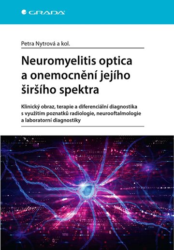 Obálka knihy Neuromyelitis optica a onemocnění jejího širšího spektra