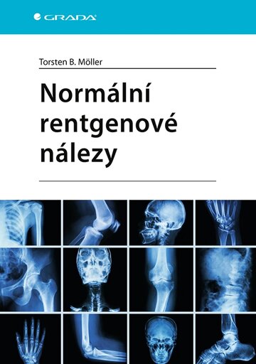 Obálka knihy Normální rentgenové nálezy