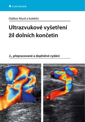 Obálka knihy Ultrazvukové vyšetření žil dolních končetin