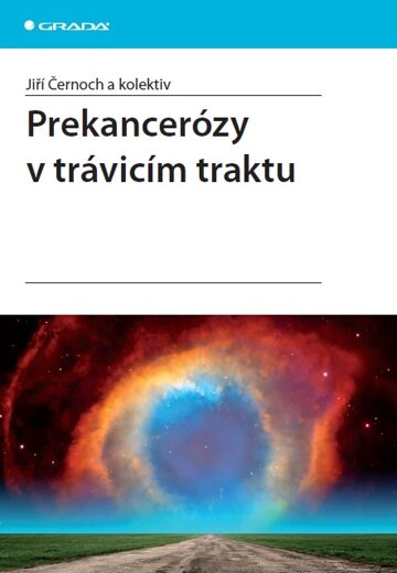 Obálka knihy Prekancerózy v trávicím traktu