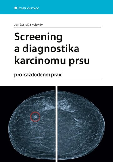 Obálka knihy Screening a diagnostika karcinomu prsu