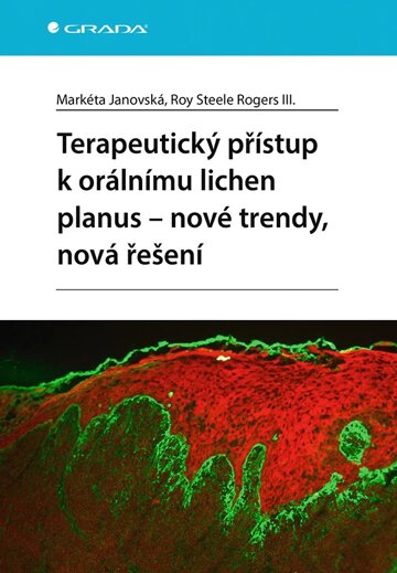 Obálka knihy Terapeutický přístup k orálnímu lichen planus - nové trendy, nová řešení